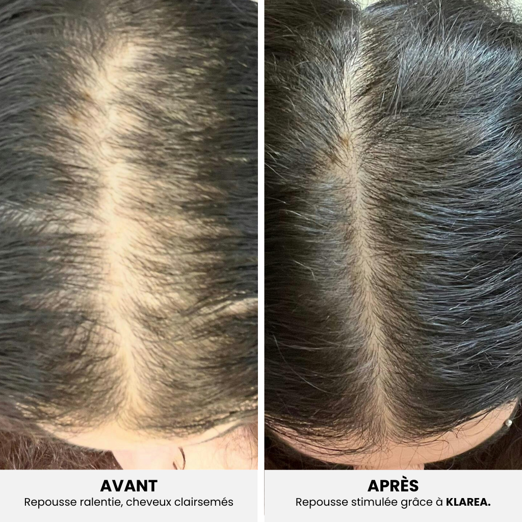 GAMAEL N°1 – Cure Pousse Cheveux