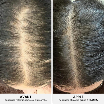 GAMAEL N°1 – Cure Pousse Cheveux