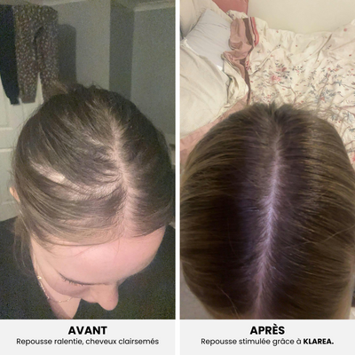 GAMAEL N°1 – Cure Pousse Cheveux