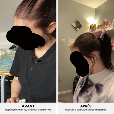 GAMAEL N°1 – Cure Pousse Cheveux