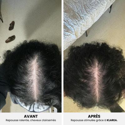 GAMAEL N°1 – Cure Pousse Cheveux