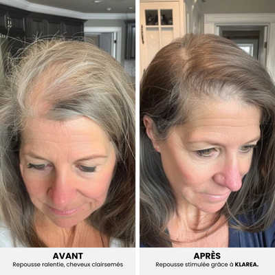 GAMAEL N°1 – Cure Pousse Cheveux