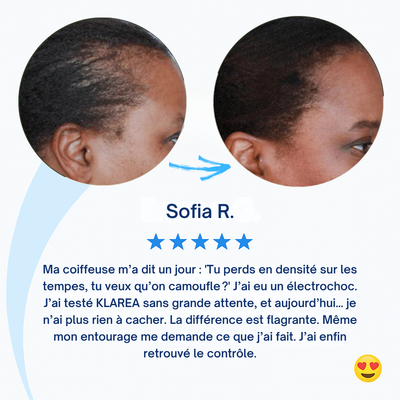 GAMAEL N°1 – Cure Pousse Cheveux
