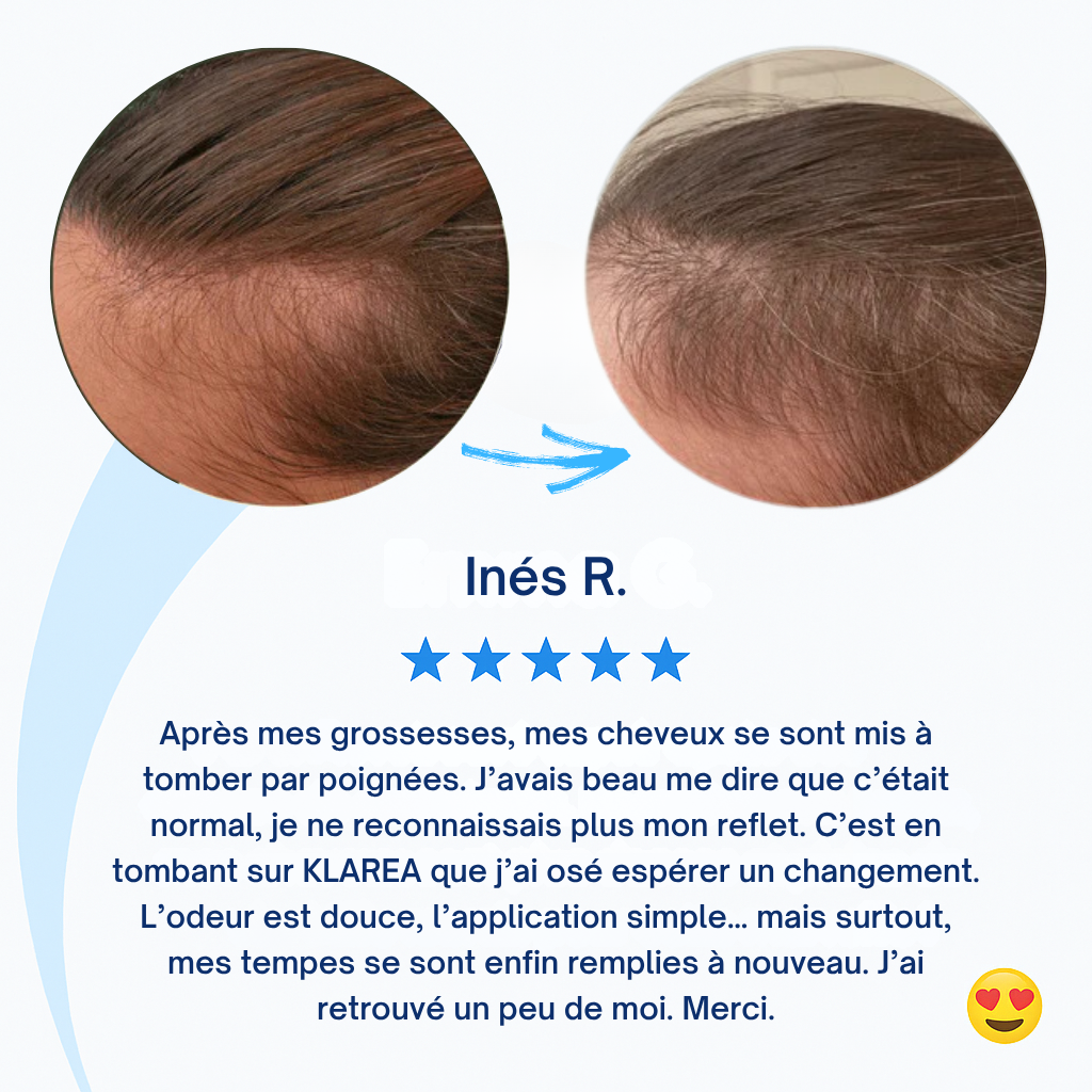 GAMAEL N°1 – Cure Pousse Cheveux