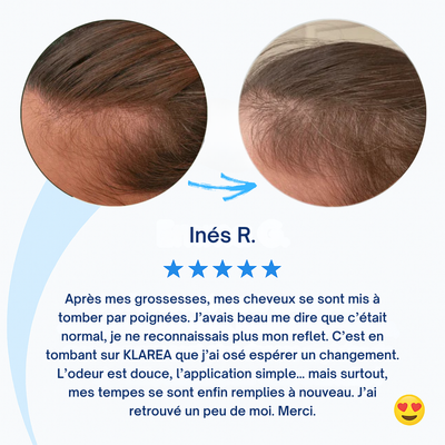 GAMAEL N°1 – Cure Pousse Cheveux